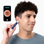 Mi Smart Wax Removal Bebird I35R