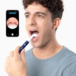 Mi Smart Wax Removal Bebird I35R